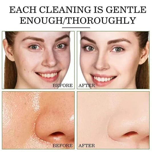 Ecrin Hair Removal Spray